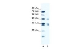 ZNF577 Rabbit anti-Human, Polyclonal, Novus Biologicals 0.1ml; Unconjugated:Antibodies,